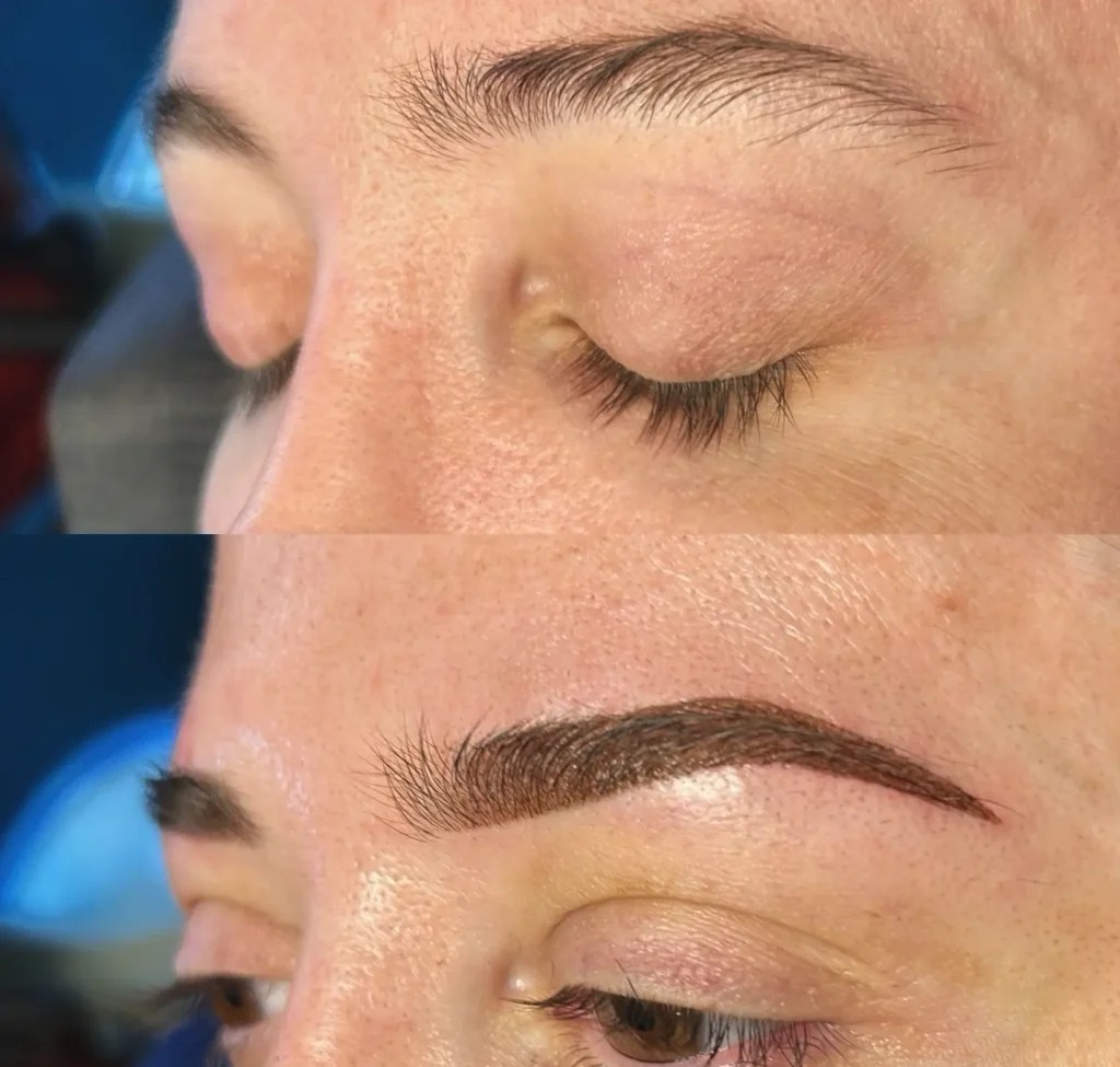Types of Cosmetic Tattooing