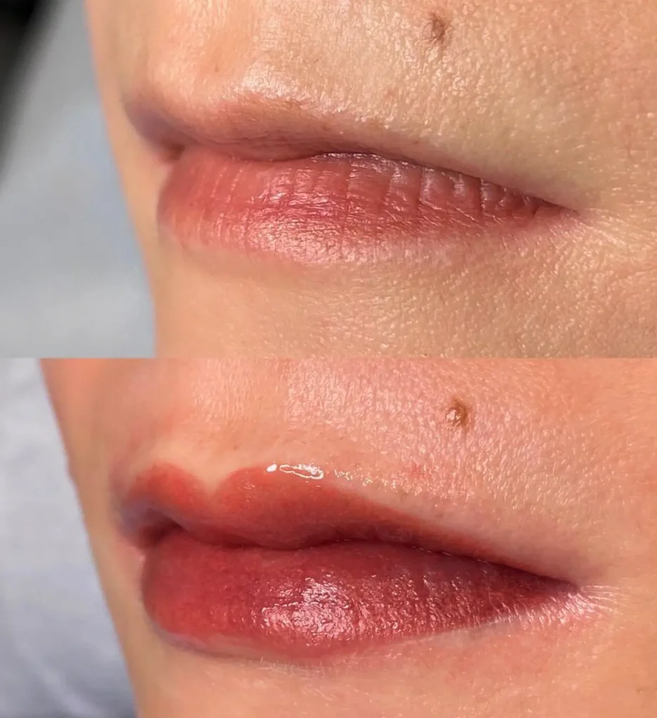 What Is Cosmetic Tattooing