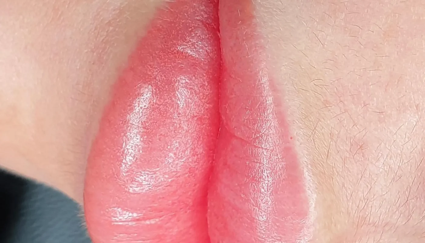 Lips Peeling After Lip Blush