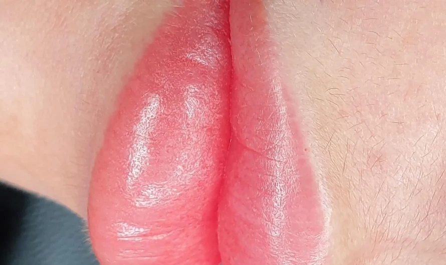 Do lips always peel after lip blushing?