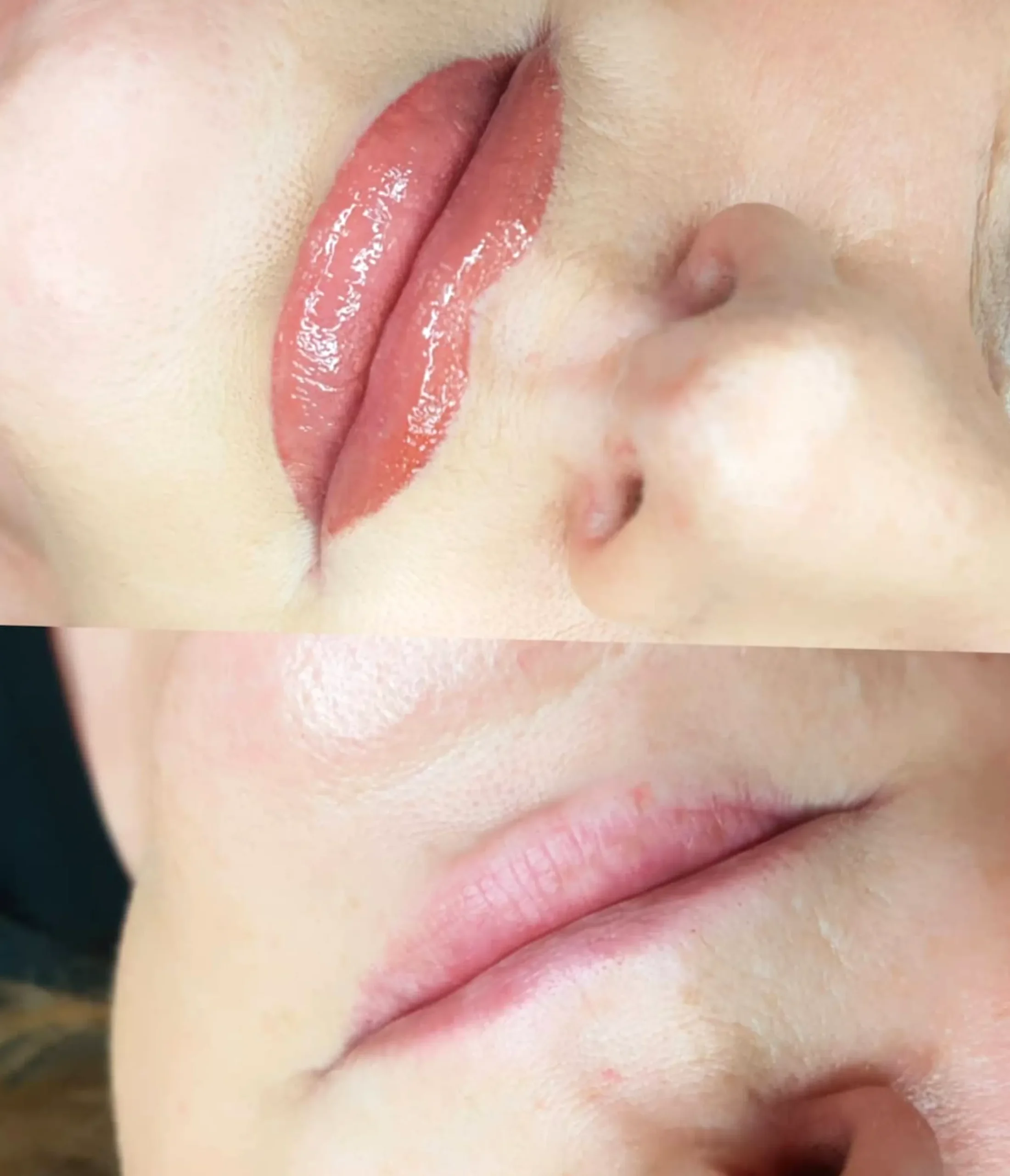 lip blush peeling stage