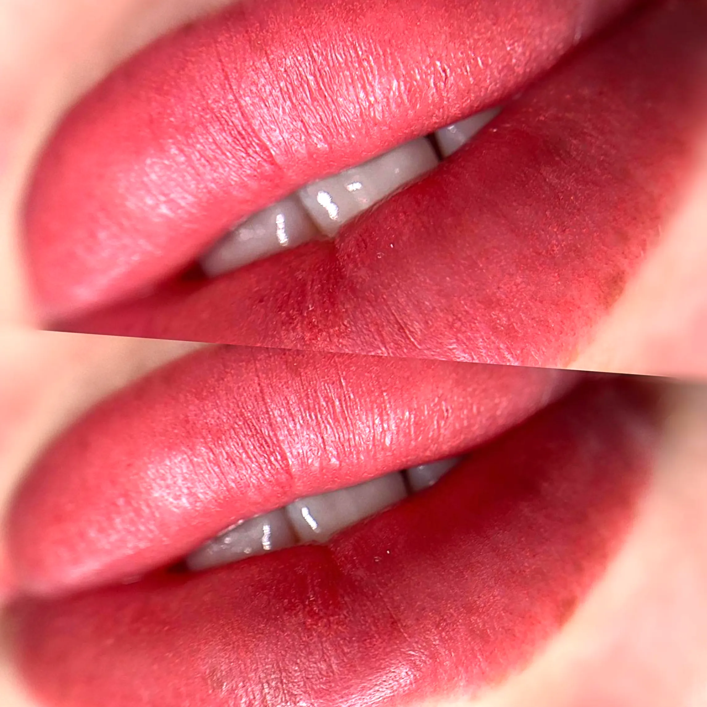 peeling vs scabbing lips