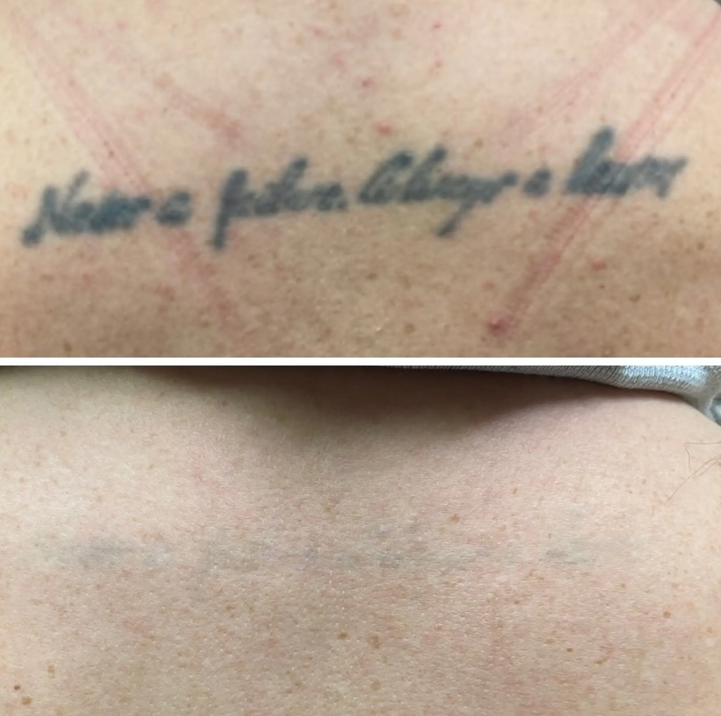 cosmetic tattoo fading before correction