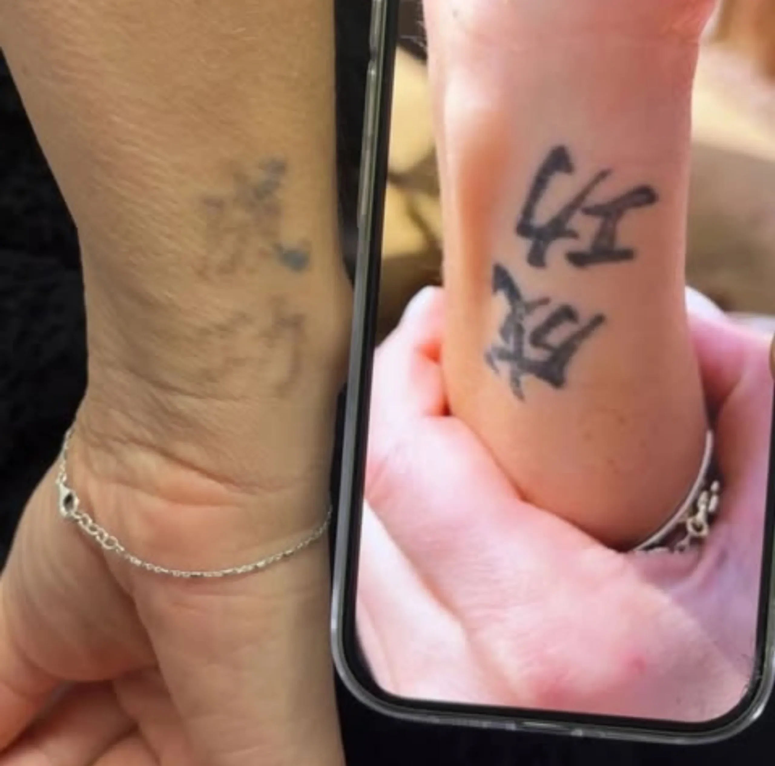fading cosmetic tattoo Melbourne